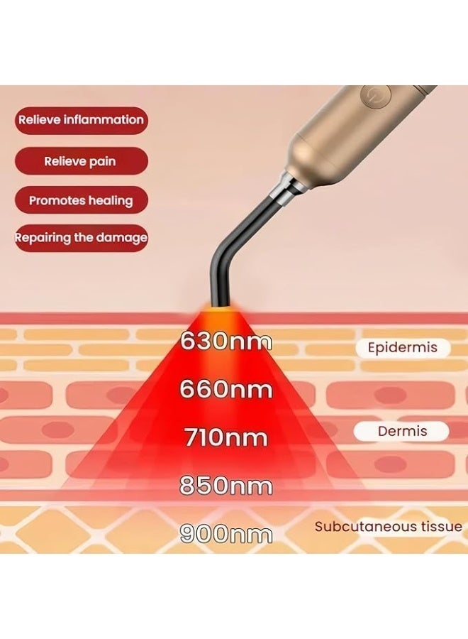 يمكن لجهاز العلاج الضوئي LED المحمول باليد هذا تخفيف الألم في الشفاه والفم والأنف والأذنين والمفاصل والعضلات؛ كما أنه مناسب لتخفيف القشعريرة والقرح وقروح البرد (660/810/850/940 نانومتر). - Image 3